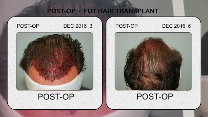 Sure Hair Transplants Toronto
