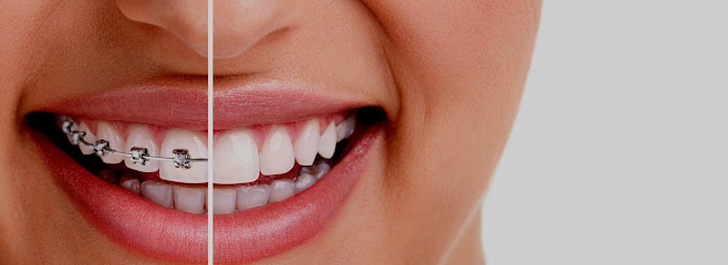 Clear Aligners Dental Clinic